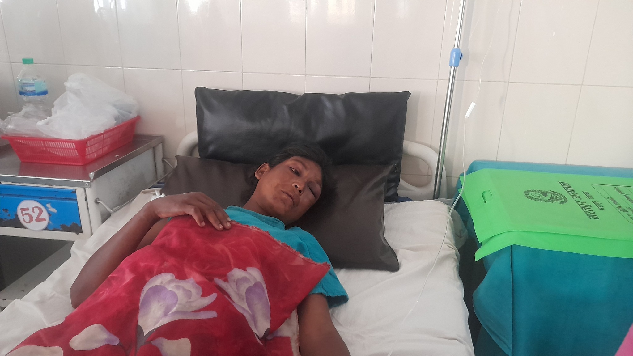 श्रीमानले मलद्वारमा लौरो घुसाउँदा सख्त घाइते श्रीमतीकाे मृत्यु